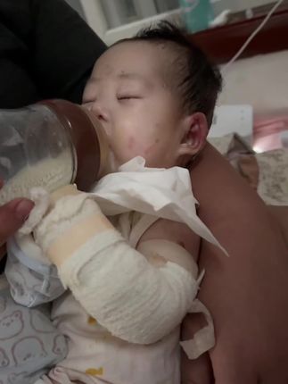 努力喝奶的宝宝#坚强的孩子 #见证成长