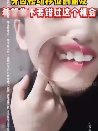 李时珍牙齿修复凝胶 #好物推荐#好物分享@抖音小助手 @DOU+小助手 #牙膏