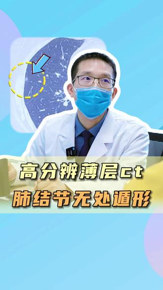 肺结节的“照妖镜”:高分辨薄层CT! #肺结节 #薄层CT #门诊日常 #抖出健康知识宝藏 #我的年度健康盘点