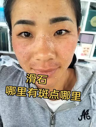#滑石#同城好店推荐给您 #同城优先推荐 #热上热门