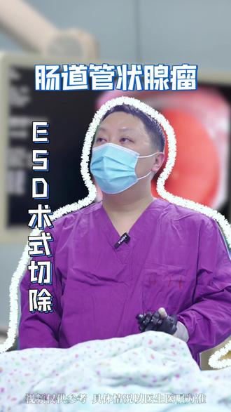肠道里的“定时炸弹”,每3个人就有一个人中招!体检查出结肠腺瘤,ESD微创手术切除,肠镜一次,安心多年!#肠镜 #肠息肉 #结肠腺瘤 #内镜手术 #ESD