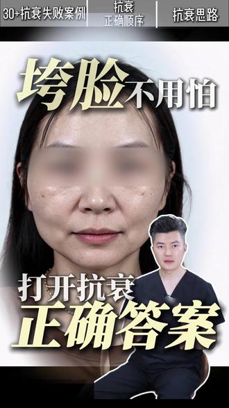 抗衰做错的代价太大了 #轮廓固定 #幼态脸 #面部提升 #抗衰 #法令纹