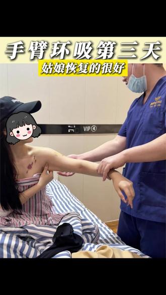 手臂环吸查房实录!! #塑形 #变美变瘦变好看 #瘦 #身材管理