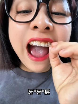 牙齿黑黑黄黄的 一用一个不吱声#爱牙护牙 可以不用去洗牙了,强烈安利给每一个牙齿黄的姐妹!#牙黄咋办 #牙齿 #一口好牙 #牙贴