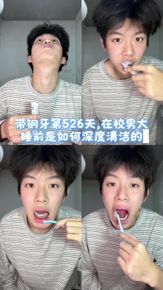 钢牙一年多,被大白夸的清洁流程,不知不觉戴牙套
526天了!一年多我很感叹的一件事就是保持牙齿好状态离不开好好刷牙~戴牙套怕牙黄,怕蛀牙的都可以通过刷牙去解决的!!#正畸日记 #钢牙 #正畸清洁流 #正畸好物推荐 #口朗特