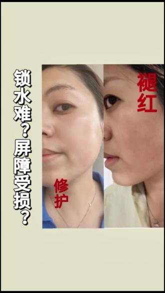 三种超绝,薇诺娜精油使用技巧大公开#精华油的妙用 #就想说点大实话 #一般人不告诉他 #行业大揭秘