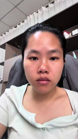 黄金微雕留还是退? #美容仪使用心得分享 #美容仪测评 #护肤真实生活分享 #极萌大熨斗美容仪 #极萌黄金微雕