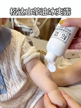 闷热的三伏天!宝宝爱出汗,脖子腋下大腿根容易红红的!#松达山茶油冰爽露 对于红红真心好使,凝露质地不飞粉不呛鼻,蕴含山茶油精华,滋润舒缓#液体爽身粉#母婴好物