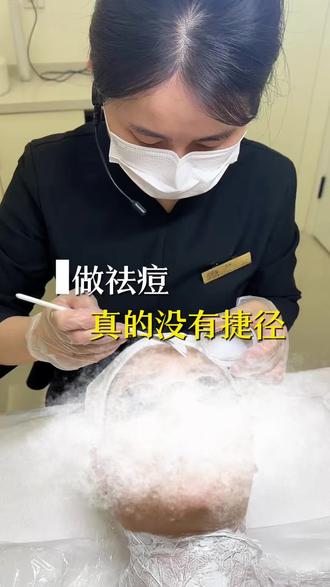 四步让你远离包包#蚌埠 #黑头 #闭口痘痘