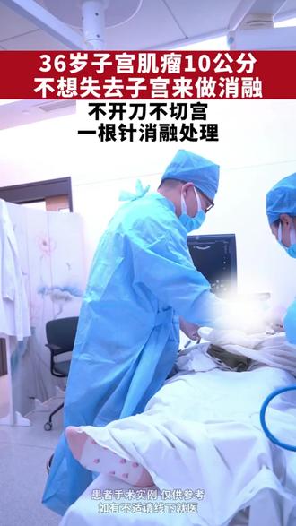 十几公分的肌瘤 患者不想失去子宫 刷到消融科普 来上海找我们 #子宫肌瘤 #子宫肌瘤手术 #微波消融 #手术室日常 #关爱女性健康