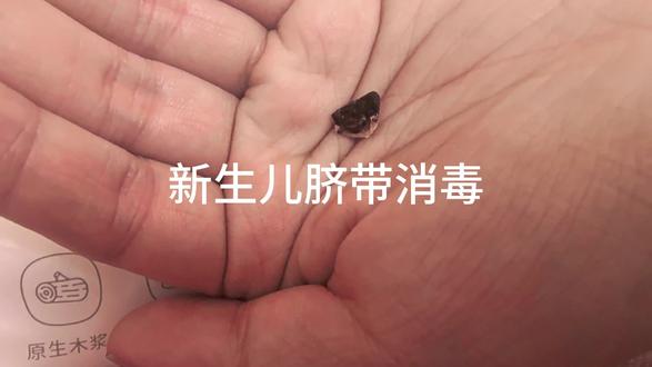 新生儿肚脐消毒
消毒有血渍都是正常的
只要没有红肿流脓发臭都是正常的
我们就正规消毒就可以
如果出现红肿流脓发臭一定要去医院哦!#新生儿肚脐眼消毒 #二胎