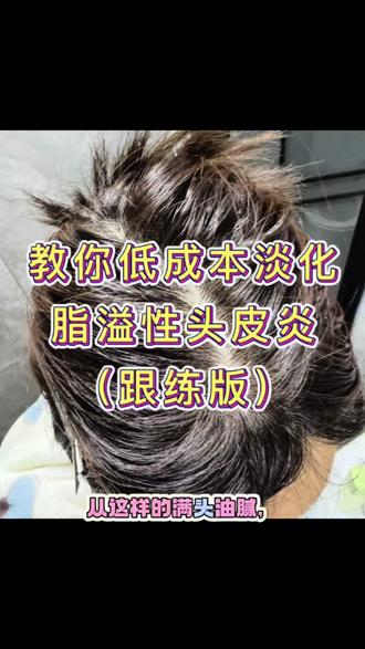 春天这样养头发#头发护理