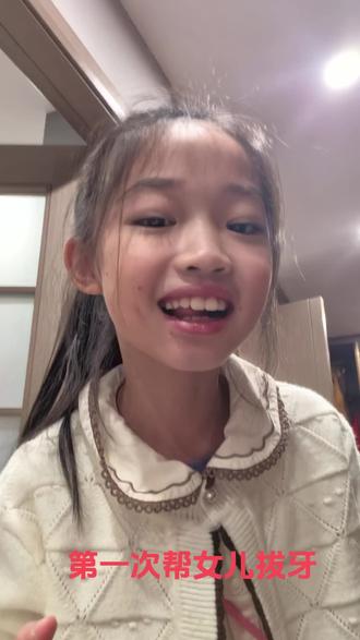 女儿的拔牙实录#vlog日常 这一次用时五分钟,看看下次要多久,反正还有大把的娃大把的牙给我练手,哈哈哈哈