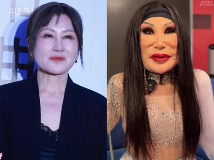 所以说,女演员还是不要轻易动脸。你看63岁的#张凯丽 ,近期亮相电影节红毯,黑色流苏西装搭配10厘米高跟,全新造型颠覆大众认知。高清镜头下她皮肤紧致透亮,身姿挺拔步态从容,笑起来眉眼间尽是飒爽气场,全然不见花甲之年的疲态。反观49岁的#林心如 ,当年的紫薇格格惊艳一代人的时光,然而如今的状态却难如人意,面部失真,连微笑都透着僵硬,全然没有了往日的自然舒适感。原来,真正的“神颜”从来不是依赖医美堆砌的精致假象,而是靠后天的坚持与努力。难怪近几年娱乐圈集体抛弃馒化手段,颖宝从发腮疲态脸逆袭成紧致建模脸,杨幂摆脱显老感重拾少女灵动,蒋欣也告别脸部松弛,如今抬眼尽是明眸桃花相。她们究竟是如何做到越老越年轻的?其中的代表人物韦雪无疑是最成功的,年仅40岁却比20岁时更显年轻态。她也毫不吝啬地在直播间分享了女明星惊艳回春的秘诀。#韦雪 #眼膜推荐 #好物分享