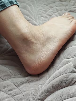 冬天不可缺少的脚后跟防干裂膏#凡士林干裂棒 #倍护膏#手脚干裂#滋润保湿