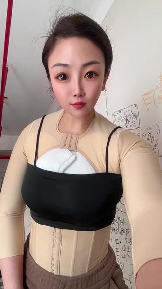 记录人鱼体雕后背手臂一字肩副乳富贵包术后第3️⃣天,已洗澡消毒,轻微肿胀感,不疼无任何不适感,期待每天的恢复变化✌🏻#人鱼体雕#蜕变过程 #身材管理是女人一生的必修课 #谁还不是小腰精 #爱自己的一百种方式