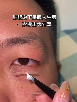 眼皮松弛 眼尾下垂都能撑出大外双#无美颜无滤镜拍摄