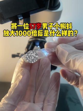 将一位57岁男子小蝌蚪放大后是什么样的?#显微镜 #显微镜下的世界