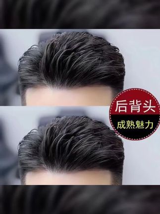 男士假发男大背头头顶补发片额头生物隐形无痕全真发侧背头假发片#好物推荐🔥 #头发护理 #男士发型 #发型教程 #男生发型打理技巧
