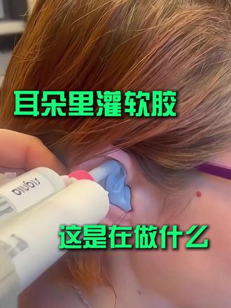耳朵里灌软胶,这是什么操作 #科普