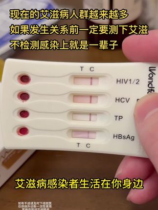 现在的艾滋病人群越来越多,如果发生关系前一定要测下艾滋这个东西,一定要抓紧测!#健康 #涨知识 #关爱女性健康
