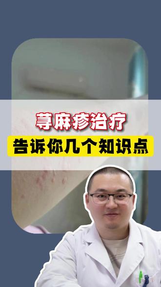 荨麻疹治疗告诉你几个知识点 #荨麻疹 #皮肤科