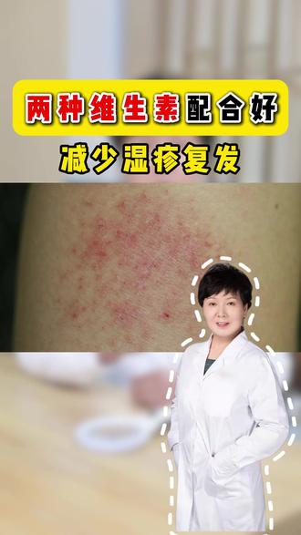 两种维生素配合好 减少湿疹复发
