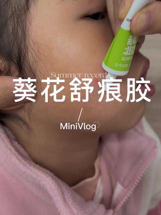 孩子开学后,更加容易打闹,这款#疤痕凝胶 就很合适,葵花大品牌,更值得信赖#疤痕 #疤痕遮盖 #育儿经验分享 #宝妈必备好物