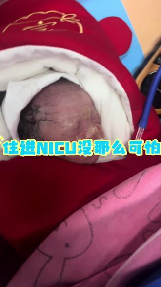 宝宝住进NICU别慌张!超全‘闯关’流程 我家宝宝是NICU里的小战士。当时我感觉天都塌了,充满了未知和恐惧。但后来才明白,NICU不是一个可怕的地方,而是一个专门帮助宝宝们“打怪升级”的VIP护航基地!💪
了解流程,真的能消除90%的焦虑。来,收下这份暖心版“闯关”指南!👇
🆘 第一关:解决呼吸问题
✔️ 快速安检:给宝宝做一个全身“快速扫描”。我们宝宝早产(32周➕1),第一关就是呼吸窘迫综合症,从无创呼吸机→有创呼吸机(发了一万多的注射用牛肺表面活性剂,不能报销💔)→鼻氧→箱氧→自主呼吸🫁
没用有创药的时候,我们这时候还是很紧张的,宝宝自己也是很努力的打怪兽
---
🩺 第二关:检查感染问题
等宝宝稳定下来,就会开始一套非常细致的“全身体检”,目的是找到问题,精准治疗。
🧬 “微量”血检:只取一点点血,查感染、肝功能、营养状况等,宝宝负担很小。
📷 必备“拍照”:
• 胸片:看看小肺肺是否健康。
• 心超:给小心脏做个精细检查。
• 头超(尤其早产宝宝):通过囟门无痛检查大脑,非常安全
💕 第三关:喂养
谁说NICU里爸妈只能干着急?我们可是宝宝的“专属能量站”!
🍼 母乳是金奶:我不焦虑,本身计划奶粉喂养,但是他早产,我想母乳一定能增加免疫力的,我每天按时喝水、吃饭,即使宝宝还不能自己吃,特别是前期的黄金初乳,一定给宝宝喝,增强免疫力,爸爸每天送到医院,妈妈专心在家产奶,爸妈是你坚强的后盾💪
---
🎓 第四关:毕业准备 · 回家倒计时!
当宝宝达成以下成就,就快要“毕业”回家啦!
✅ 自助餐达标:能自己用力吸奶,吃饱饱。
✅ 体温自理:离开暖箱也能维持正常体温。
✅ 体重“涨涨涨”:从出生的5斤,目前40天已经到10斤啦,目前还在持续增重中……
✅ 呼吸平稳:像个小大人一样呼吸顺畅。
✨ 最后,想对准爸妈说:
1. 信任团队:NICU的医生护士是宝宝临时的“天使爸妈”
2. 照顾好自己:妈妈好好坐月子,爸爸跑前跑后,你们安好,才是宝宝晴天。
3. 这是暂时的:NICU之旅只是宝宝人生中一个特殊的起步,他在为未来的奔跑积蓄力量。
每一个NICU宝宝都是坚强的小勇士,而你们,是他最强大的后盾。别怕,我们一起加油!🌟
---
#nicu#新生儿 #早产儿 #育儿经验 #拒绝焦虑