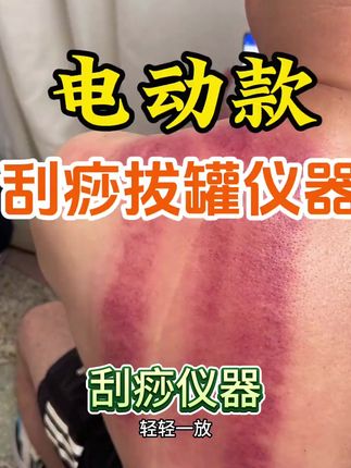 #按摩仪 可拔罐 可刮痧可热敷,自己用送长辈都合适