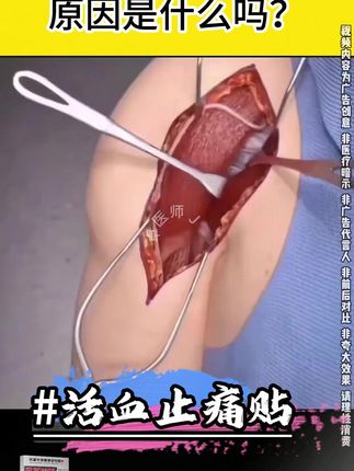 肩周,腰椎,膝盖,颈椎,足跟,足底,全身肌肉关节!贴就完了!官方正品!