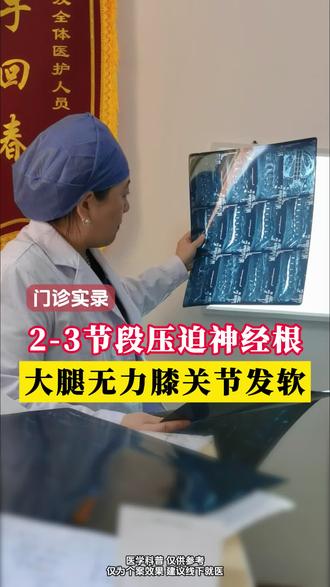 23节段压迫神经根,大腿无力膝关节发软 #大腿无力 #腰椎间盘突出 #颈椎病 #中医 #骨科