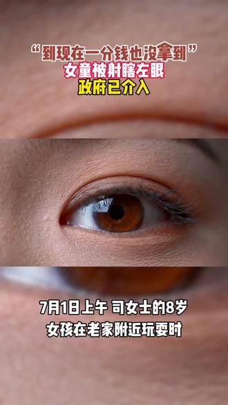 “到现在一分钱也没拿到!”女童被射瞎左眼,政府已介入#射瞎左眼 #政府已介入 #女童