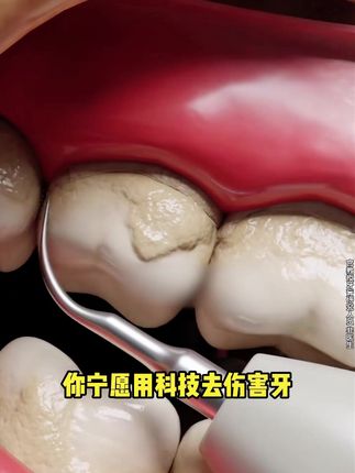 经得起专业调研和大众考验的产品,值得更多人看见!#宫教授美白牙膏#牙黄