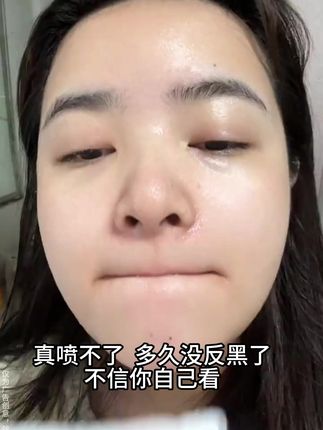听我的,要是你也是斑斑点点,脸上暗沉无光,你就试试,早晚涂~#美白淡斑#护肤