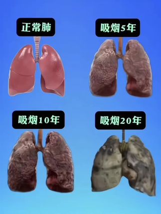 本来以为是智商税,现在真的后悔没早买!万万没想到啊!抱着试试看的心态,绝了!#好物推荐#强烈推荐 #我捡到宝了 #生活必备#每日分享