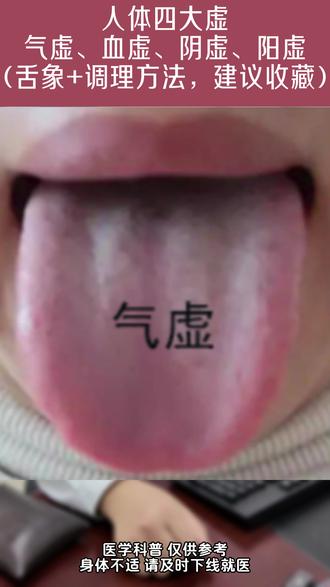 人体四大虚:气虚、血虚、阴虚、阳虚! (舌象+调理方法,建议收藏)#中医 #健康 #舌象分析 #舌诊 #四大虚