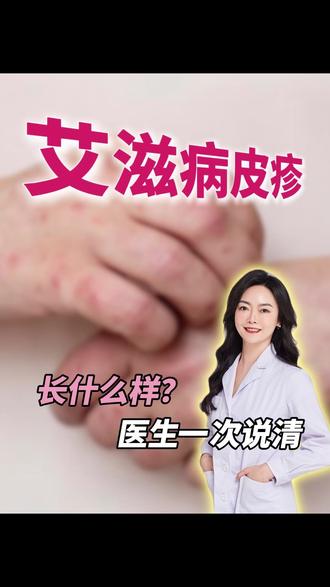 #艾滋病 皮疹长什么样?一条视频讲清楚!五一出去玩的注意啦!#艾滋病患者 #抖出健康知识宝藏 #艾滋病传播途径 #医疗健康创作训练营 @抖音小助手