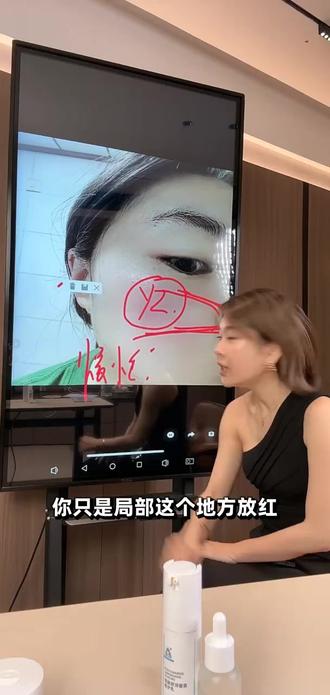灭🔥 #反反复复起疹子 #发红发热#敏感肌#皮肤屏障受损