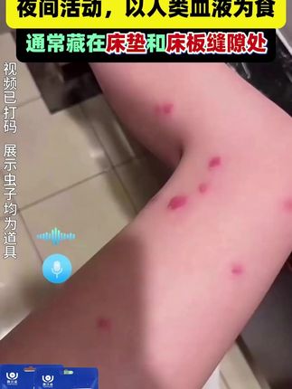 如果你经常浑身刺痒,头发易掉落,背上爱长痘,那么你的床上有螨虫在作怪!赶紧备上这个除螨包试试吧