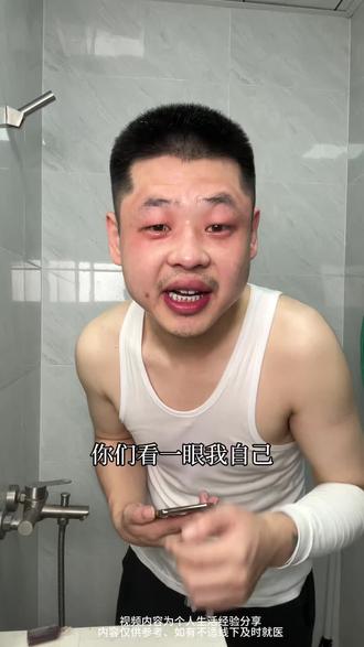 我就是这么操作的#掉发#掉头发厉害#掉头发怎么办