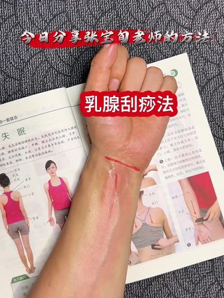 张宝旬乳腺刮痧养生好方法刮痧 #养生就是养健康 #刮痧 #生活小妙招 #中医养生 #乳腺健康 @一汽丰田 #15万级激光雷达安全标杆