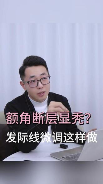 额角断层显秃?发际线微调这样做#植发 #医生科普 #植发际线 #脱发