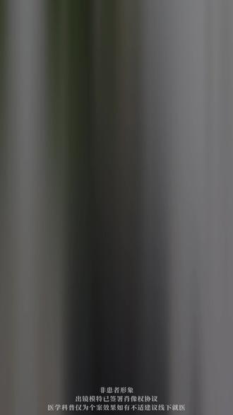 为什么别人打少女又美又年轻 而你却结节肉芽肿。关健在这.. #少女针 #少女针可以溶解吗 #少女针安全吗 #少女针填充 #北京王芳