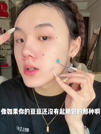 有了这个痘贴就没有东西能阻挡我的美貌啦!! #痘痘贴 #痘痘贴推荐 #长痘 #美美过春天