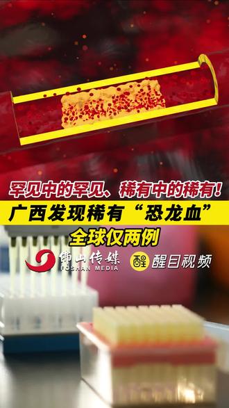 罕见中的罕见、稀有中的稀有!广西发现稀有“恐龙血”,全球仅两例!(出镜:白靖;编辑:黎晓彤;责编:黄燕飞;素材来源:广西日报 、南国早报)#热点 #老百姓关心的话题 #罕见 #万万想不到 #社会百态 不敢带你回广西