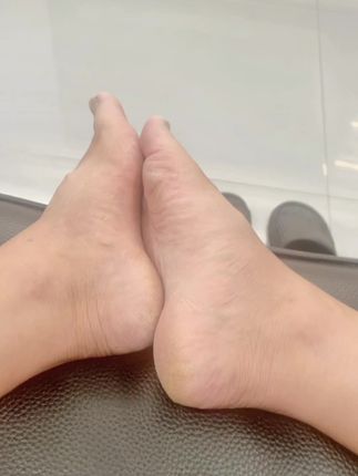 太受罪了,还好发现它# 真菌王# 足部护理 家人们,如果你也有脚臭脚痒、干裂脱皮的问题,那你一定要试试这个真菌王手足止痒膏,它是植物草本温和配方,每天早晚涂一次,让你清清爽爽,不再烦恼。