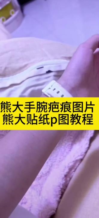 熊大手腕疤痕图片 熊大贴纸p图素材 熊大贴纸p图教程 #醒图 #醒图创作者 #熊大手腕贴纸p图教程 #熊大手腕素材 #熊大贴纸p图素材 熊大搞笑贴纸p图 熊二贴纸p图素材 熊大贴纸正方形贴纸 熊二贴纸 熊出没纹身贴纸 熊出没纹身贴 熊大熊二手腕贴纸纹身p图教程 熊大手腕疤痕图片白底图