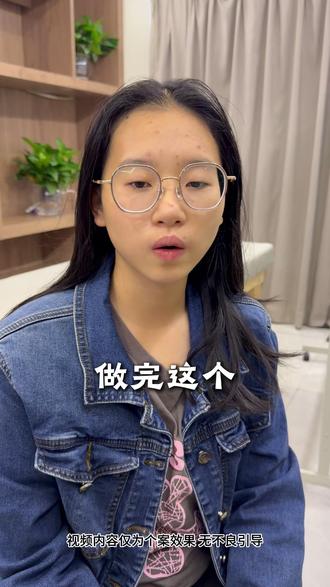17岁女生戴镜5年,体验思櫑木护眼 #近视#爱眼护眼 #戴眼镜 #孩子近视 #中山近视防控