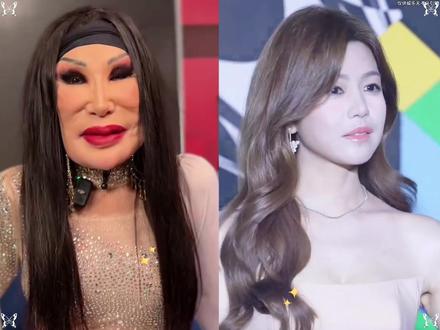 所以说,女演员还是不要轻易动脸。你看,在新剧《狙击蝴蝶》中, 42 岁的#陈妍希和 36岁的#陈小芸 ,饰演闺蜜,两人相差近10岁,不仅看不出年龄差,而且陈妍希状态更胜一筹。在剧中原生颜值依旧能打,肌肤紧致光滑,镜头怼脸也尽显通透饱满,状态稳到惊艳,简直梦回当年青春偶像剧《那些年我们追过的女孩》中,那清纯动人的沈佳宜。再看51岁的贾静雯和45岁的姚晨演闺蜜,不仅毫无违和感,而且皮肤状态更是略胜一筹。反观很多同期的女明星,却在臃肿的道路上越走越远,过度医美,被玻尿酸硬控,整个人已经抑制不住的麻化僵硬,全然没了往日的自然舒适感。但是你又会发现近几年明星回春悄无声息,颖宝从发腮疲态脸到紧致建模脸,杨幂从原来的显老横秋到现在的少女感满满。还有蒋欣曾经被嘲松弛的脸到现在抬眼都是明眸桃花相,她们是怎么做到越老越年轻的,而其中的代表人物为雪是最成功的,年仅40岁却比 20岁的自己更显年轻态。而韦雪也是毫不吝啬的,在直播间分享了女明星,惊艳回春的秘诀 #韦雪 #眼膜 #眼部护理